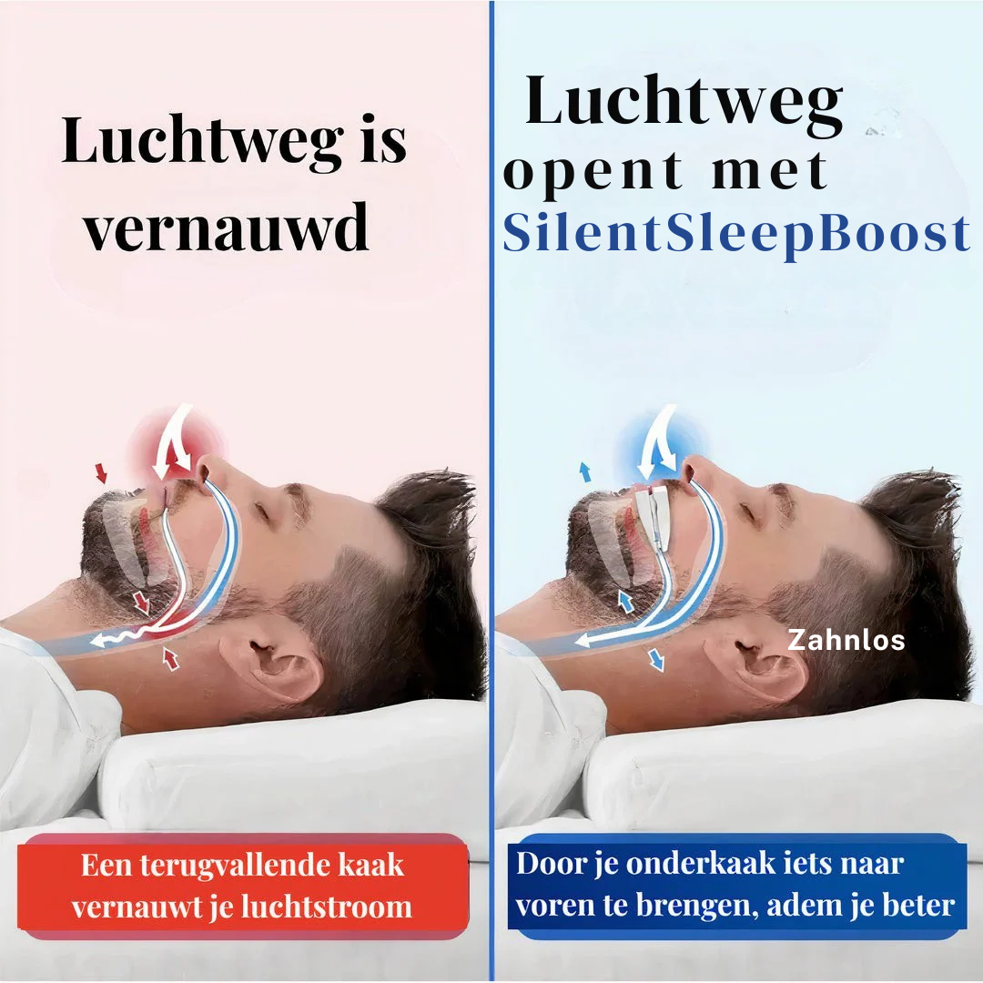 SilentSleep Apneubeugel tegen Snurken & Milde Slaapapneu – Vormbare Snurkbeugel – BPA-vrij & Comfortabel