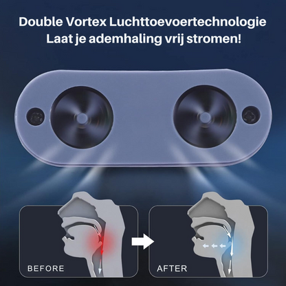 AirEase Micro CPAP slaapapneu apparaat voor op reis & anti-snurken - CPAP alternatief